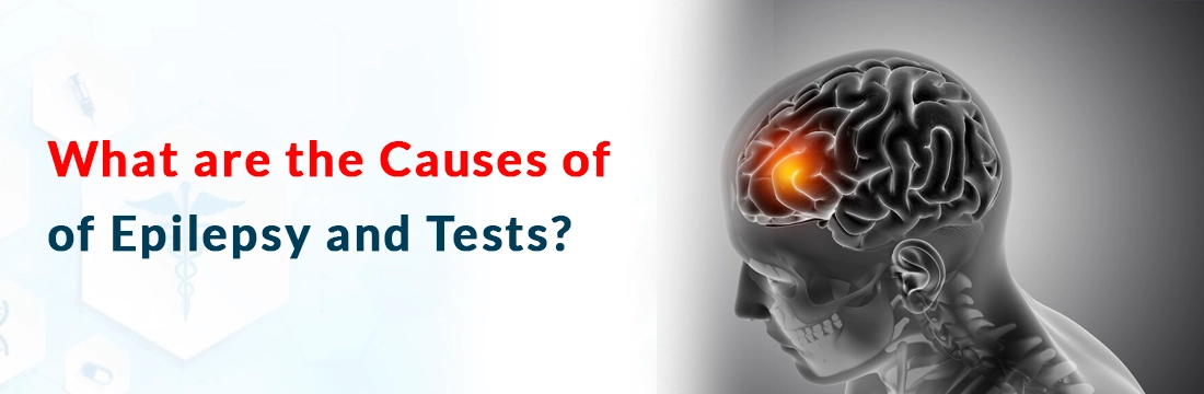  What are the Causes of Epilepsy and Tests?